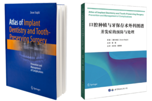 Oralna implantologija - Dental implant expert