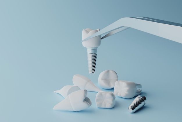 komplikacije sa zubnim implantima