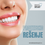 Dental Implant Expert IG